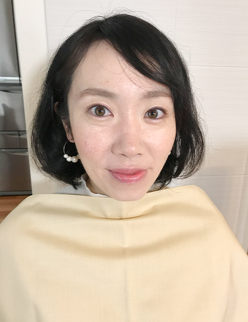 ビフォーアフターのアフター画像