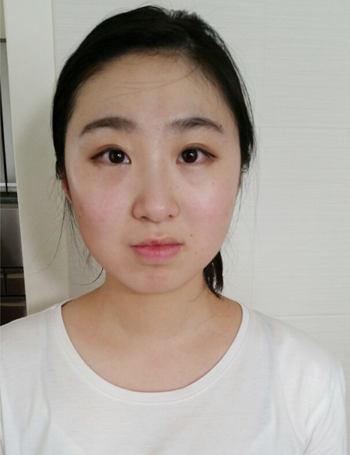 ビフォーアフターのビフォー画像